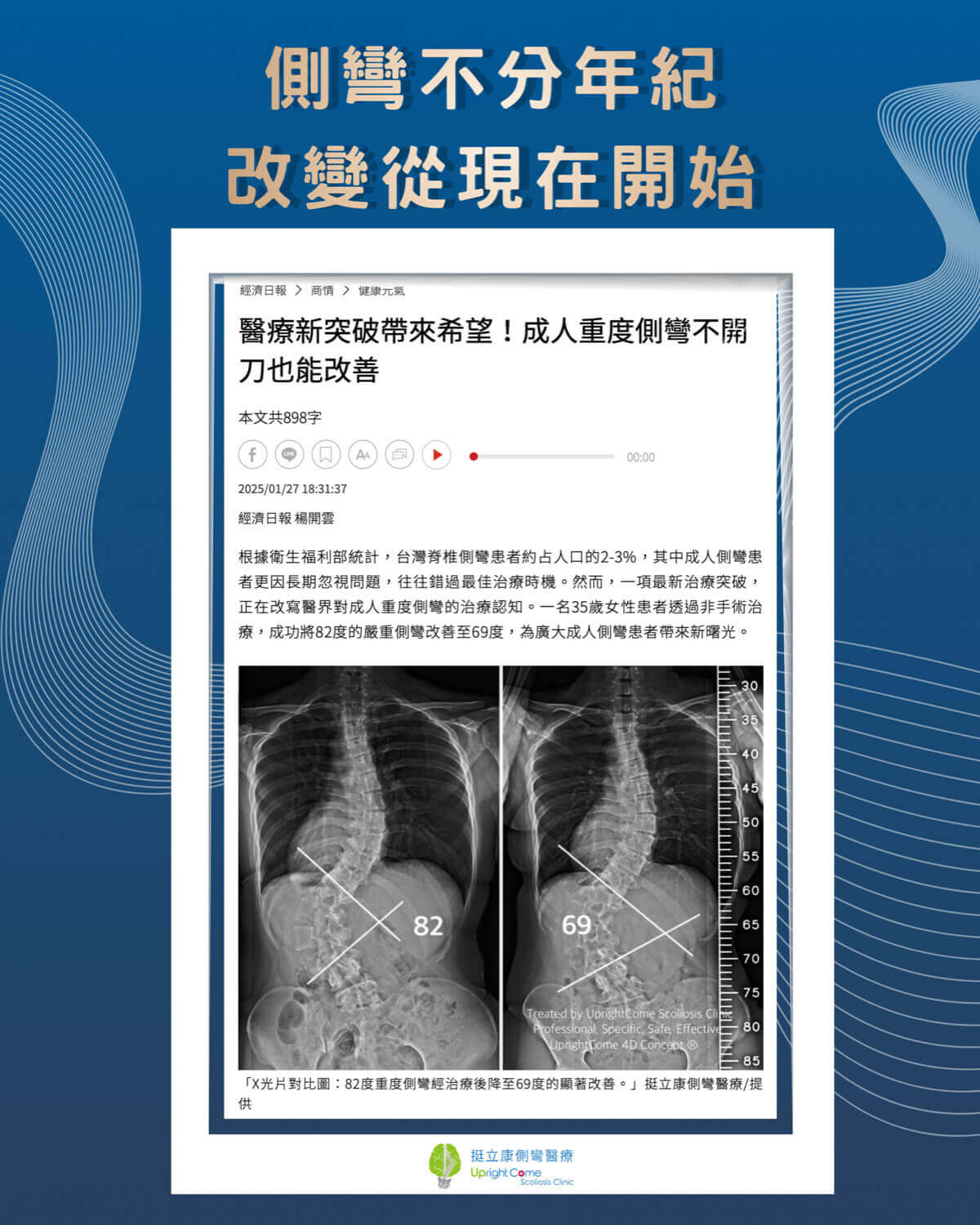 脊椎側彎矯正權威 曾琴雁主任於2011年開始擔任台北榮總脊椎側彎主治療師，於2017年獲得台灣第一位以醫師為主之「世界脊椎側彎大師傑出認定」，2019年擔任國際脊椎側彎學會理事長，並由西班牙BSPTS總部大師Dr. Manuel Rigo親自授權為官方國際講師。