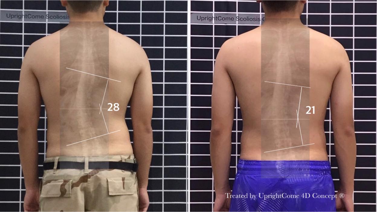 痠痛是我最在意的！