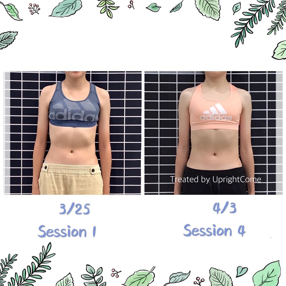 你在意的「肋骨/ 腰線」已經改變！