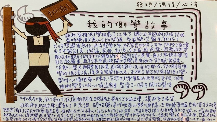 台中 / 21歲 /  男孩 / 脊椎側彎 66 度