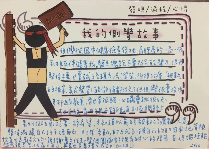 台中／20 歲／女孩／脊椎側彎 75 度
