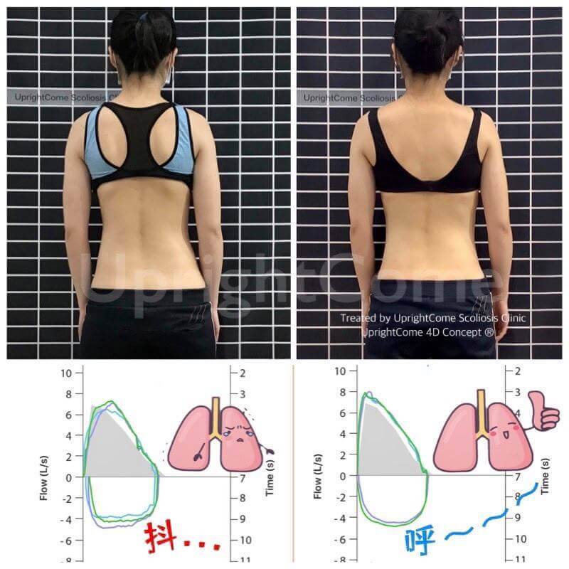 原來我的胸悶還可以改善