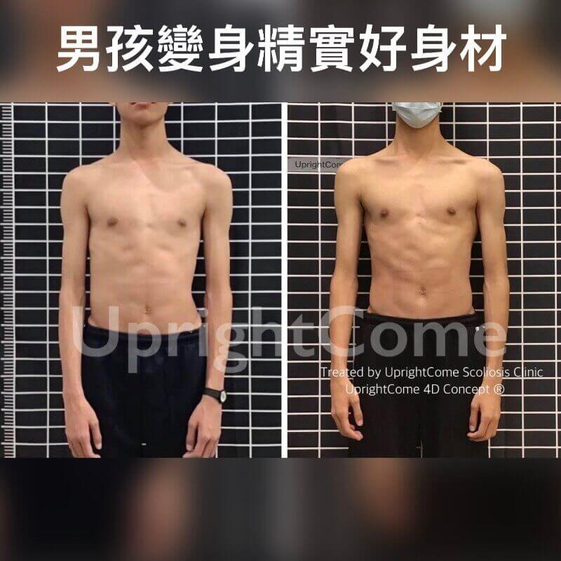 側彎矯正運動變身精實好身材