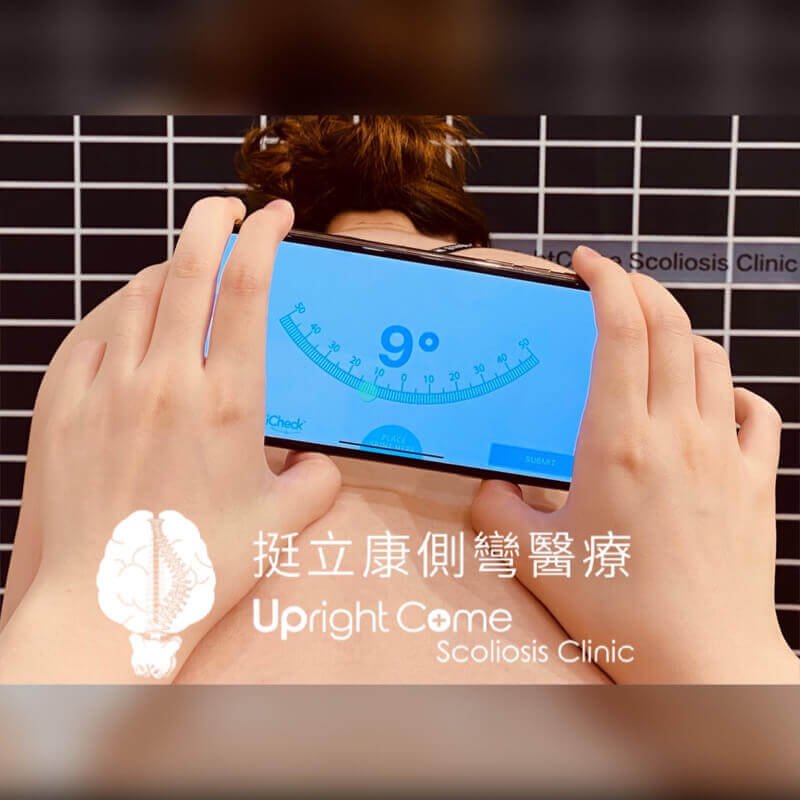 想知道怎麼居家檢測脊椎側彎嗎？讓我們來告訴你！