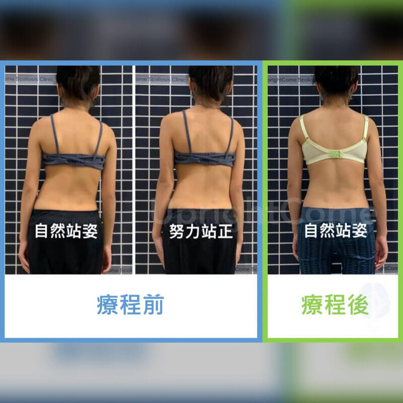 你的「正」真的「正」嗎！？