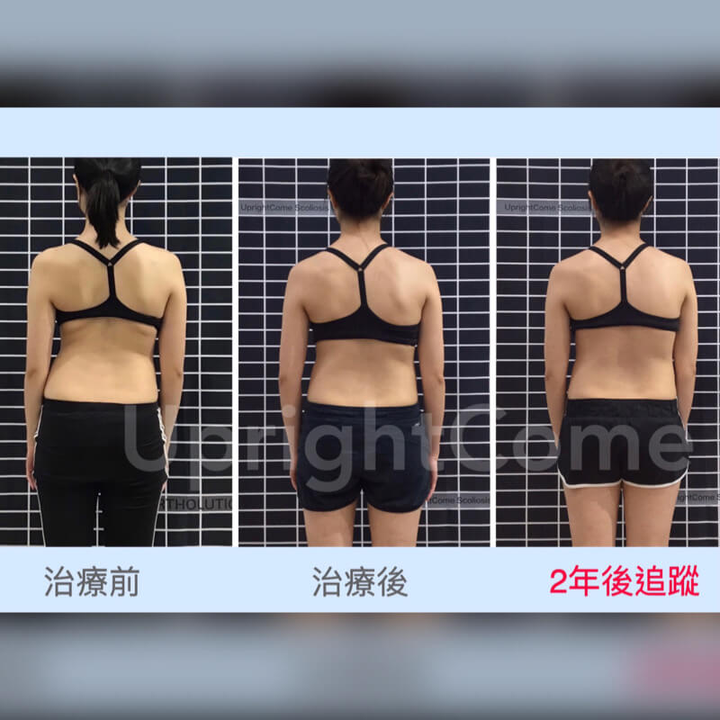 側彎女孩說：「感謝你們救了我！」