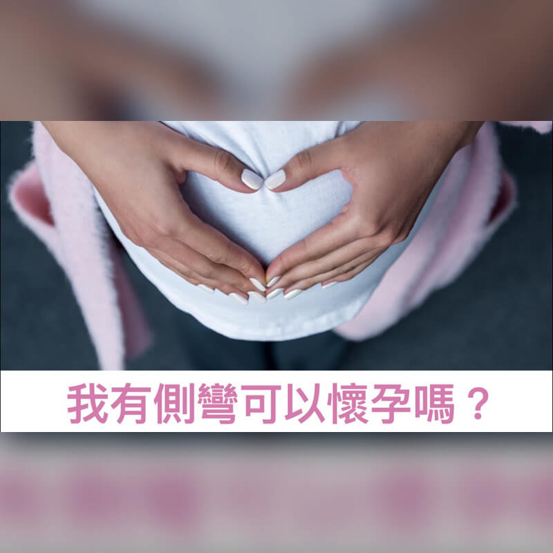 我有側彎，可以懷孕嗎？