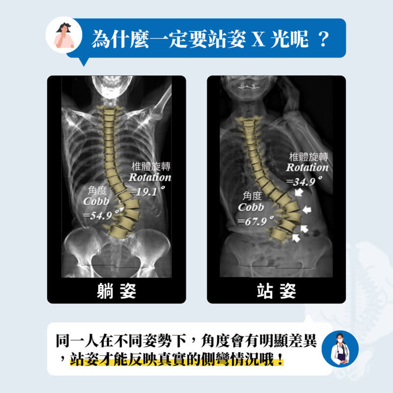 為什麼要拍『站立』的全脊柱X光呢？