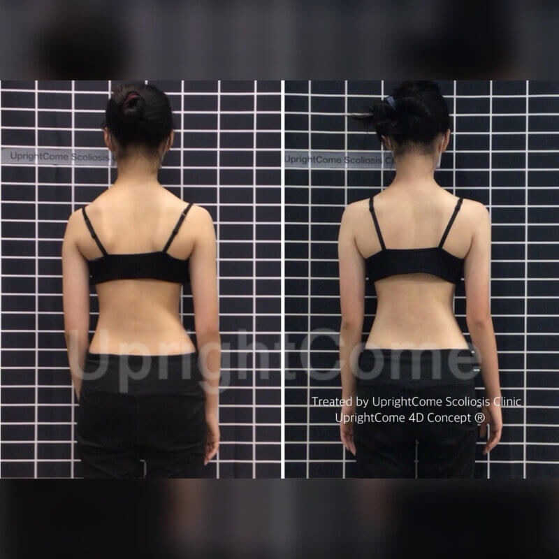 側彎人也能勇敢做音樂夢