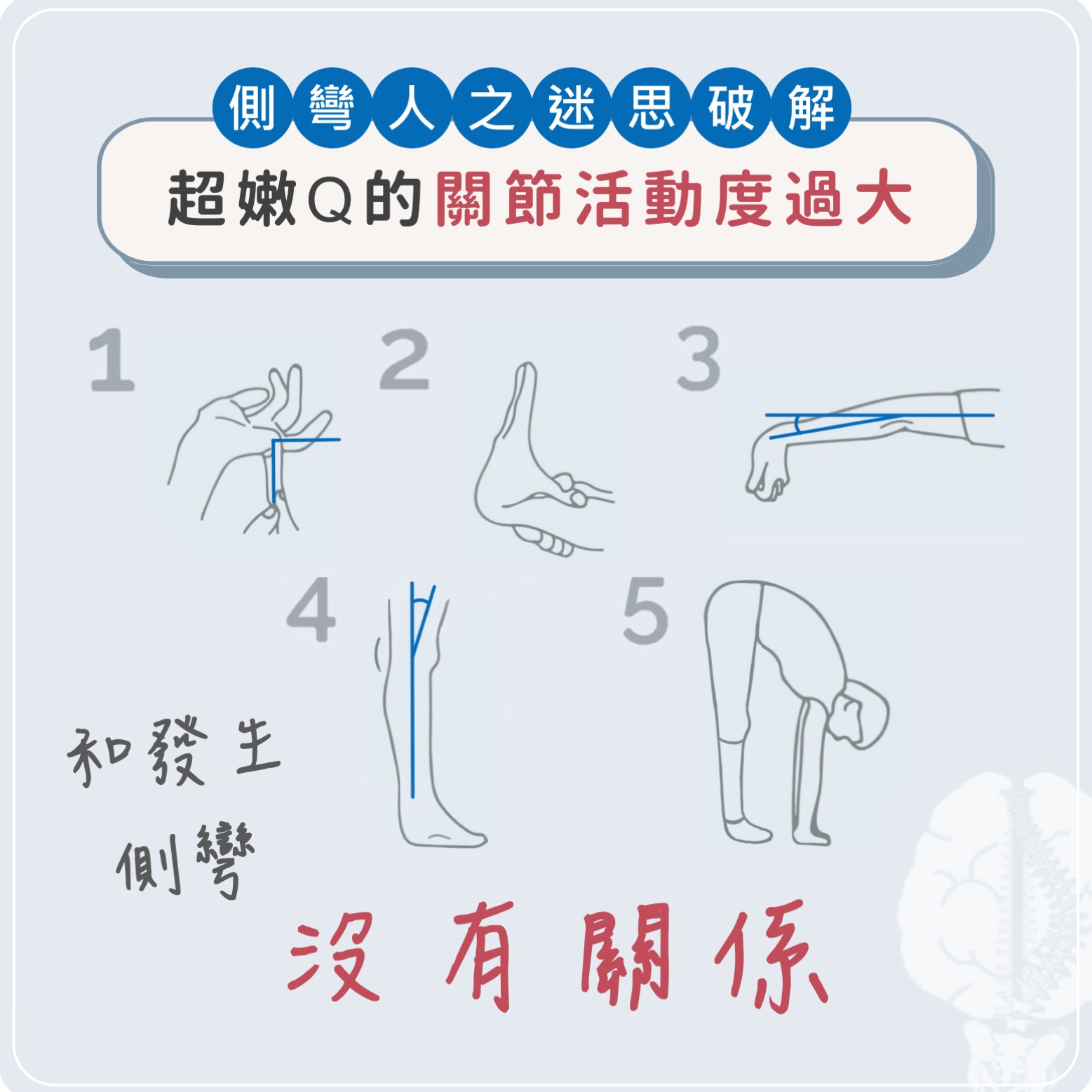 側彎人之迷思－柔軟度過大？