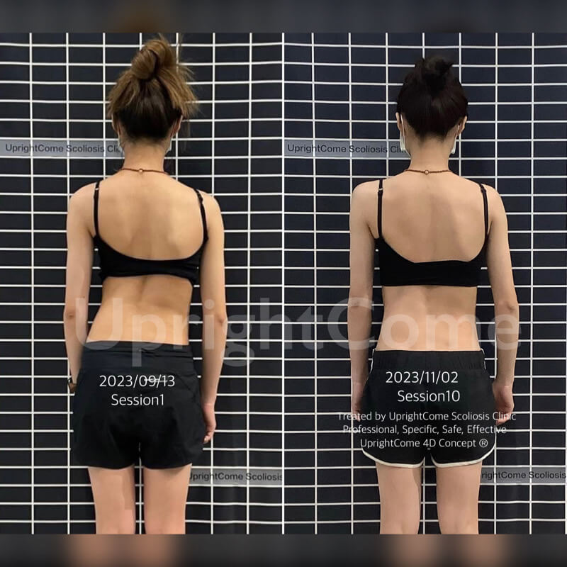 挺立康的治療給我很大的幫助