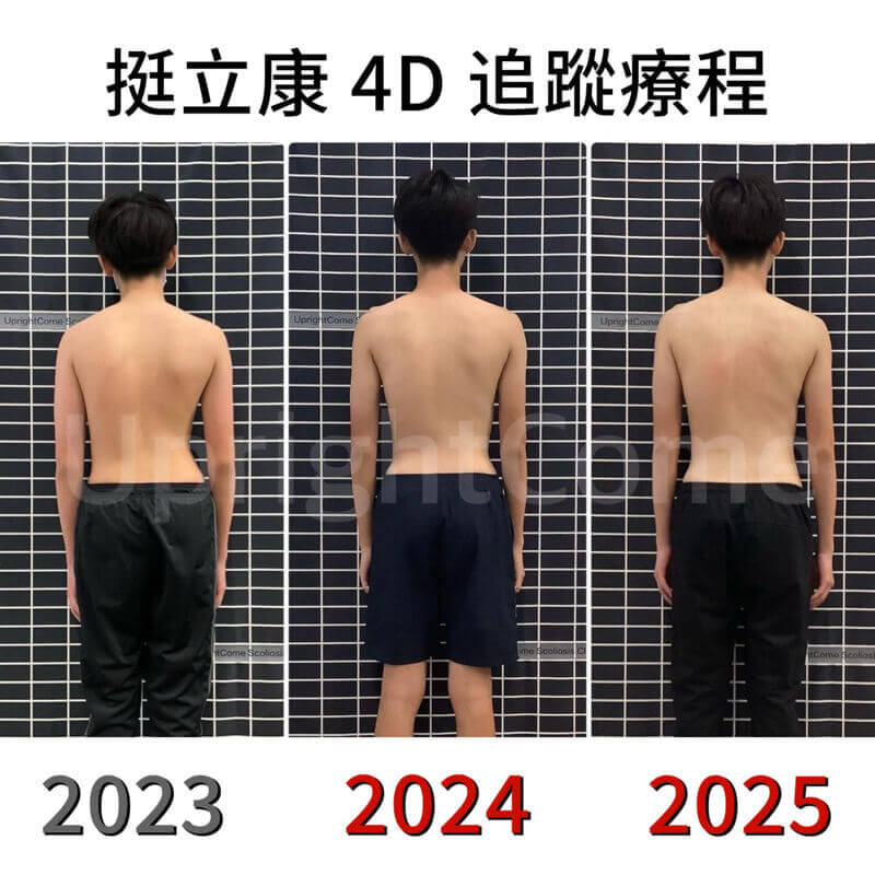 做對每一步，改變脊椎側彎未來